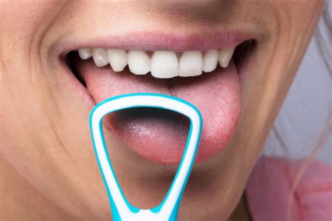 Tongue Scraping - What It Is and What It Could Do For Your Hygiene | Metro Dental Health ...