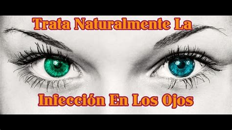 Tratar La Infección De Ojos Naturalmente Youtube