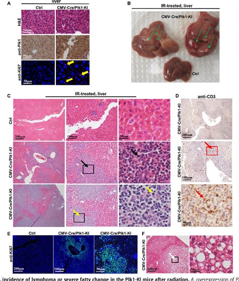 Figure 3 From Polo Like Kinase 1 Plk1 Overexpression Enhances Ionizing Radiation Induced