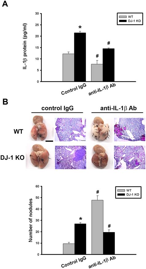 Differential Effects Of Il 1β Neutralization On Melanoma Lung Nodules