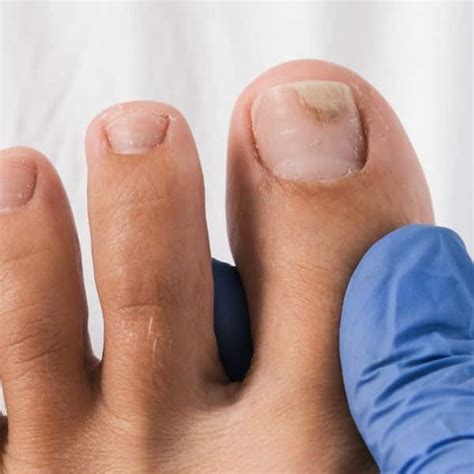 What S The Difference Between A Podiatrist And A Podologist