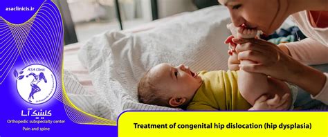 Treatment Of Congenital Hip Dislocation Hip Dysplasia