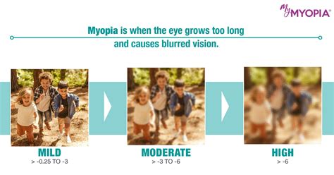 Myopia Management Texas Optical Center