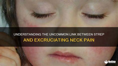 Understanding The Uncommon Link Between Strep And Excruciating Neck Pain Medshun