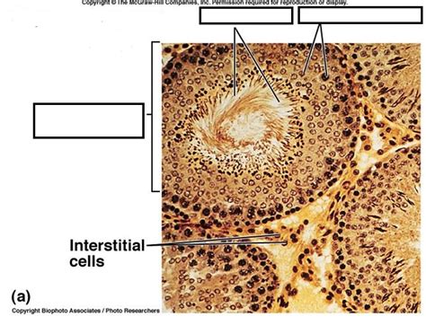 Male reproductive practical- Microscopic view of Seminiferous Tubules ...