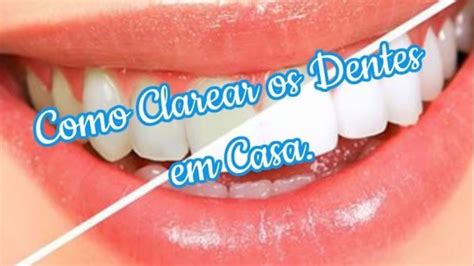 Clareamento Dental Caseiro Que Funciona Como Clarear Os Dentes