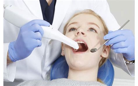 Cuál es el mejor escáner intraoral AD Medical