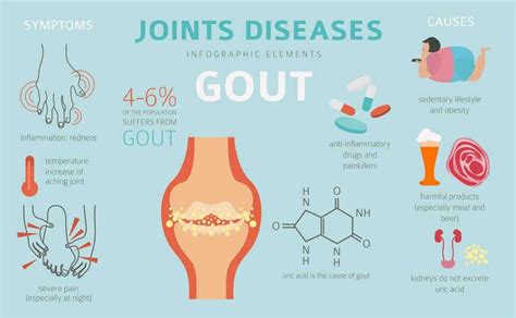 If You Have Gout and Take This Medicine - You Need to Know This | Long ...