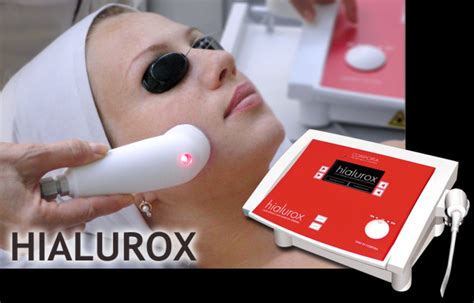 Hialurox Laserowa Aplikacja Kwasu Hialuronowego IBeauty Rumia