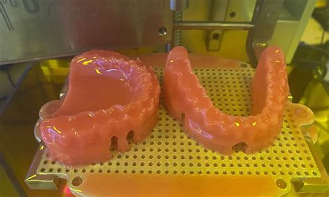 DLP 3D Printed Custom Full-mouth Resin Dentures - FacFox