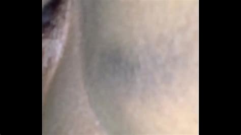 Hairy Pussy Contest Search XVIDEOS