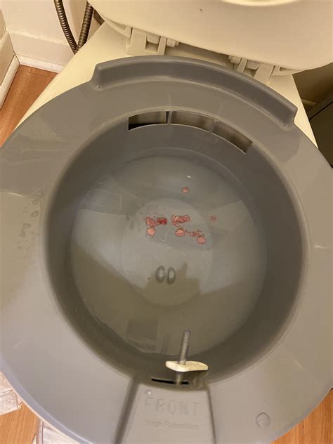 Help. I used a sitz bath and i found this when I got up. Does anyone