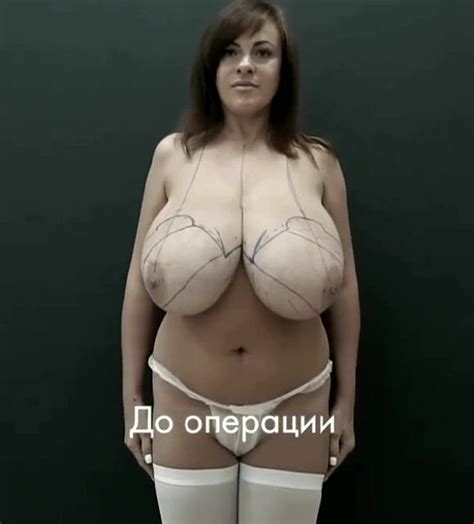 Boobies Boycott BR Surgeons ASAP Porn Video Nebyda