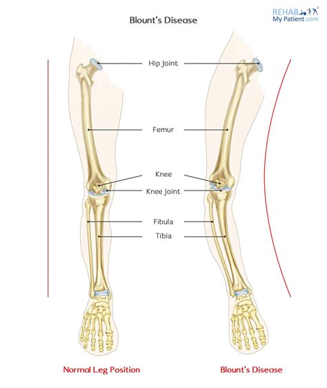 Articles | Rehab My Patient
