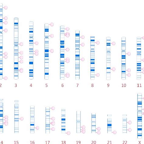 Ideograms Of Human Chromosomes With Marked Pca Susceptibility Loci