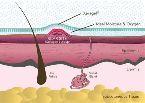 Αναπλαστική γέλη σιλικόνης Xeragel 10gr – DermaPharm Shop