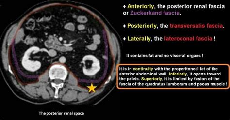 Pin de phuong hoai en CT | Radiología, Anatomía