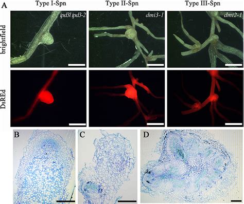 Frontiers Ipd And Ipd L Function Redundantly In Rhizobial And