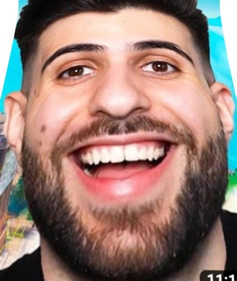 Sypher Pk Before He Knew His Skin Was Coming Out Vs After Rsypherpk