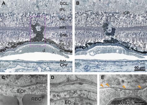 retinal pigment epithelium rpe complex   deep retinal