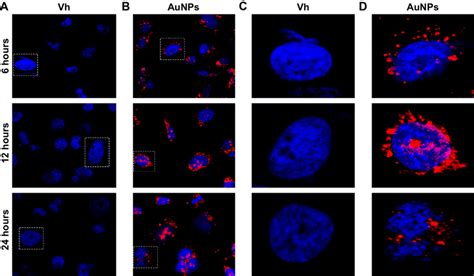 Cellular Uptake And Intracellular Spatial Distribution Of Aunps Notes