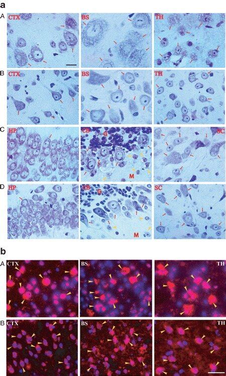 Correction Of Lysosomal Storage Pathology In The Central Nervous System