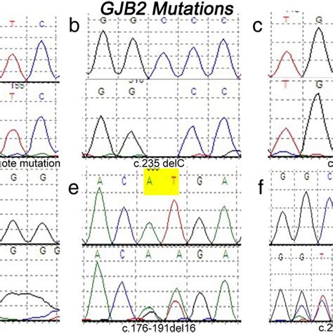 Common mutations of SLC26A4 and mt12SrRNA. Top: sequence in the control ...
