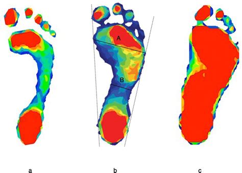 Example Of Digital Foot Pressure Data These Feet Represent Three