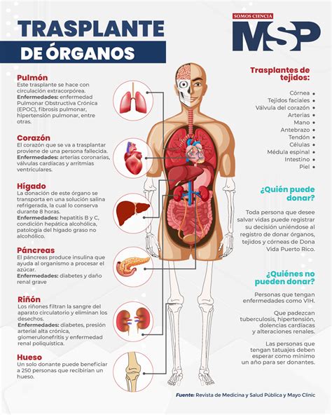 Trasplante de órganos