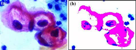 malignant cells  malignant cells extracted   original image