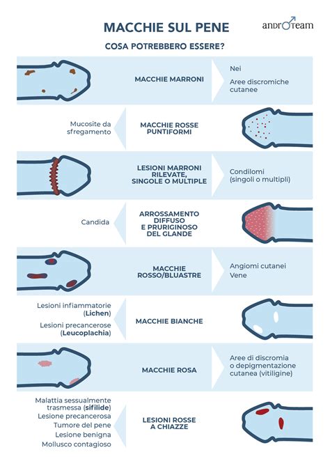 Macchie sul pene: tutto quello che devi sapere - Androteam