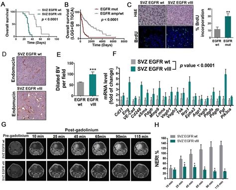 SVZ EGFRvIII Gliomas Show Increased Angiogenesis But Decreased Vascular