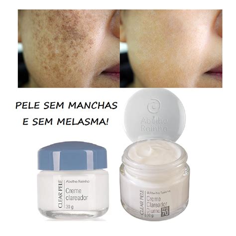 Kit Creme Clareador Diurno FPS 70 P Manchas E Melasma Creme Facial