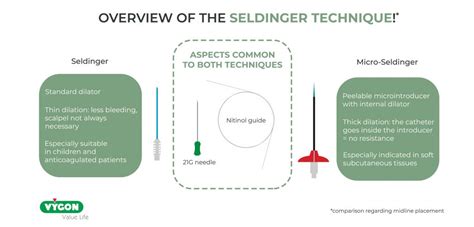 Seldinger Technique When To Use The Classical Or Modified Method