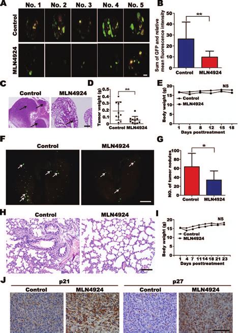 Efficacy Of Neddylation Inhibition On Experimental Lung Metastasis