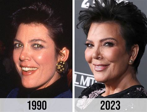 Fans Suspect Kris Jenner, 68, Got A New Facelift After Looking