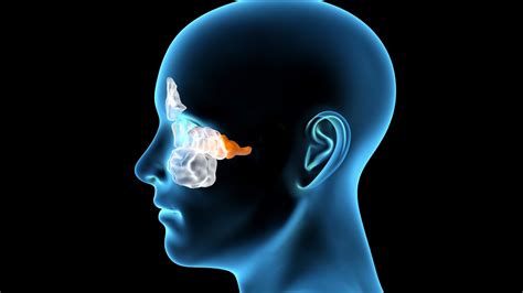 Sinus Caverneux D Finition Irm Thrombose