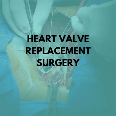 Heart Valve Replacement Surgery