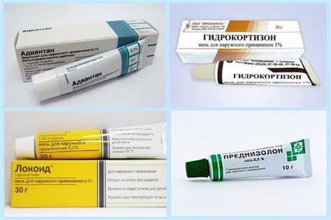 Мази от экземы: список эффективных гормональных и негормональных ...