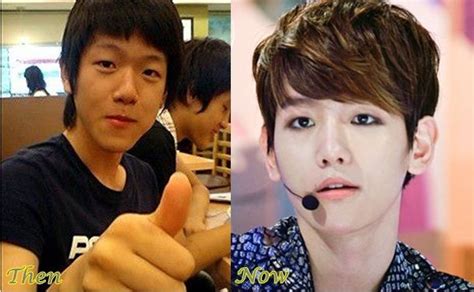 Exo Before After Plastic Surgery 2021