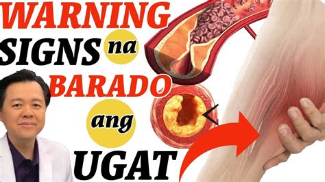 Warning Signs Ng Barado Ang Ugat Alisin Ang Bara Payo Ni Doc Willie Ong