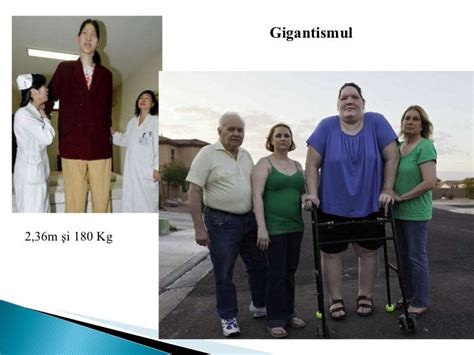 Glandele Endocrine