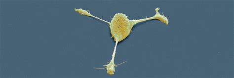 Tumor Stroma Guide To How Cellular Actors Of The Tumor