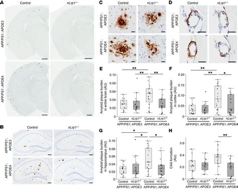 JCI - APOE4-mediated amyloid-β pathology depends on its neuronal ...