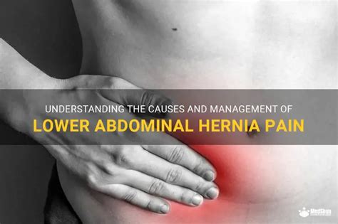 Understanding The Causes And Management Of Lower Abdominal Hernia Pain ...