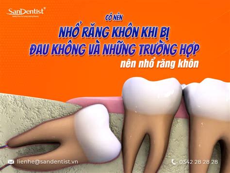 Có nên nhổ răng khôn khi đang bị đau hay không San Dentist