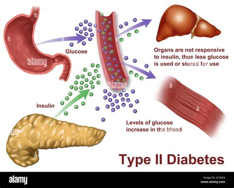 Insulin Pancreas Diagram