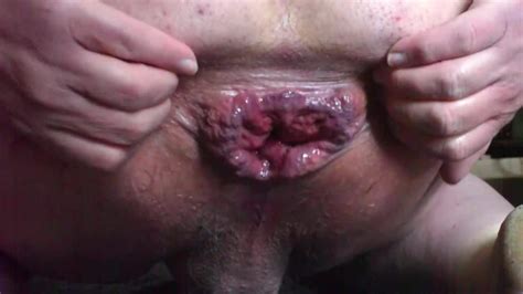 Ice Anal And Gaping Gay Amateur Amateur Porn Xhamster