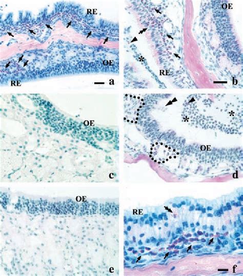 Figure 5 From Tissue Specific Effects Of Allergic Rhinitis In Mouse