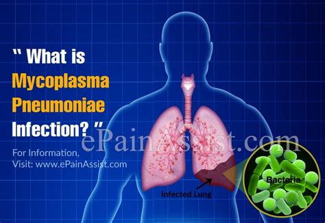 mycoplasma pneumoniae infection   symptoms